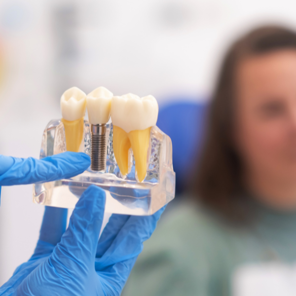 Restorative Dentistry: Dental Implants, Crowns and Bridges