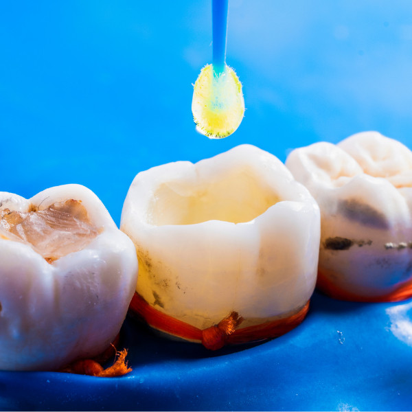 Tooth Fillings and Repairs