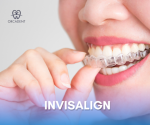 Invisalign